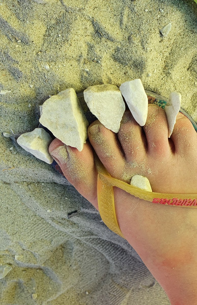 childfoot with stones, normal? - Ronald Hotz